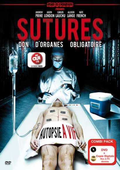 Sutures Poster
